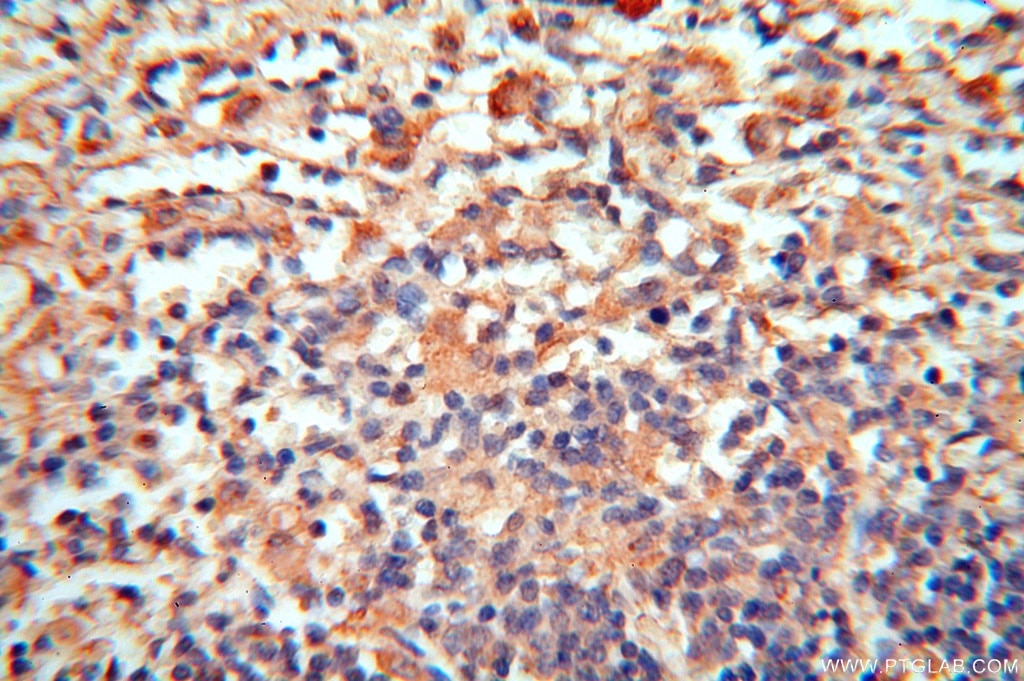 IHC staining of human spleen using 16357-1-AP