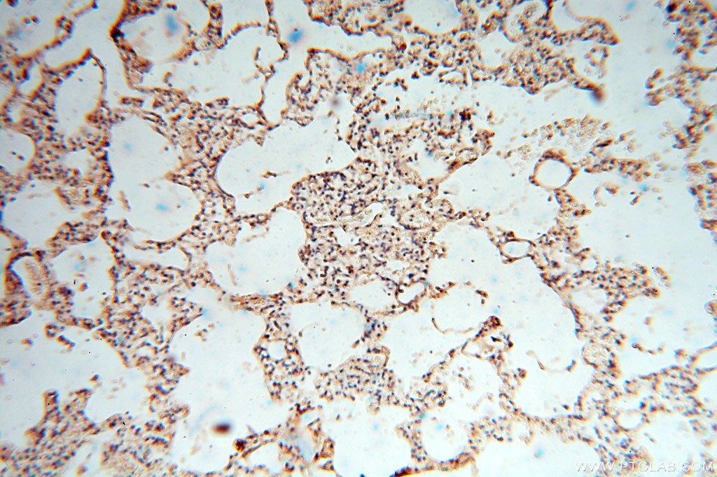 Immunohistochemistry (IHC) staining of human lung tissue using cyclin I Polyclonal antibody (16357-1-AP)