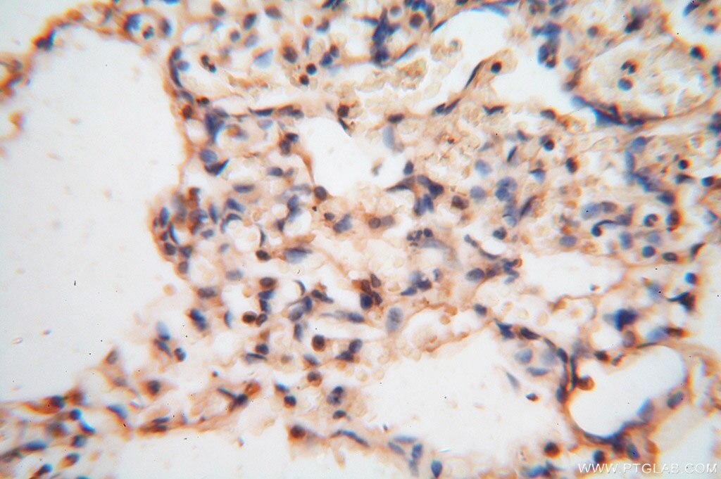 Immunohistochemistry (IHC) staining of human lung tissue using cyclin I Polyclonal antibody (16357-1-AP)