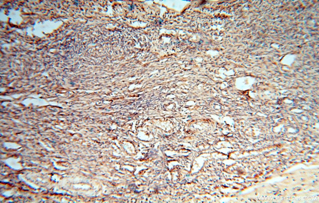 Immunohistochemistry (IHC) staining of human ovary tissue using cyclin I Polyclonal antibody (16357-1-AP)