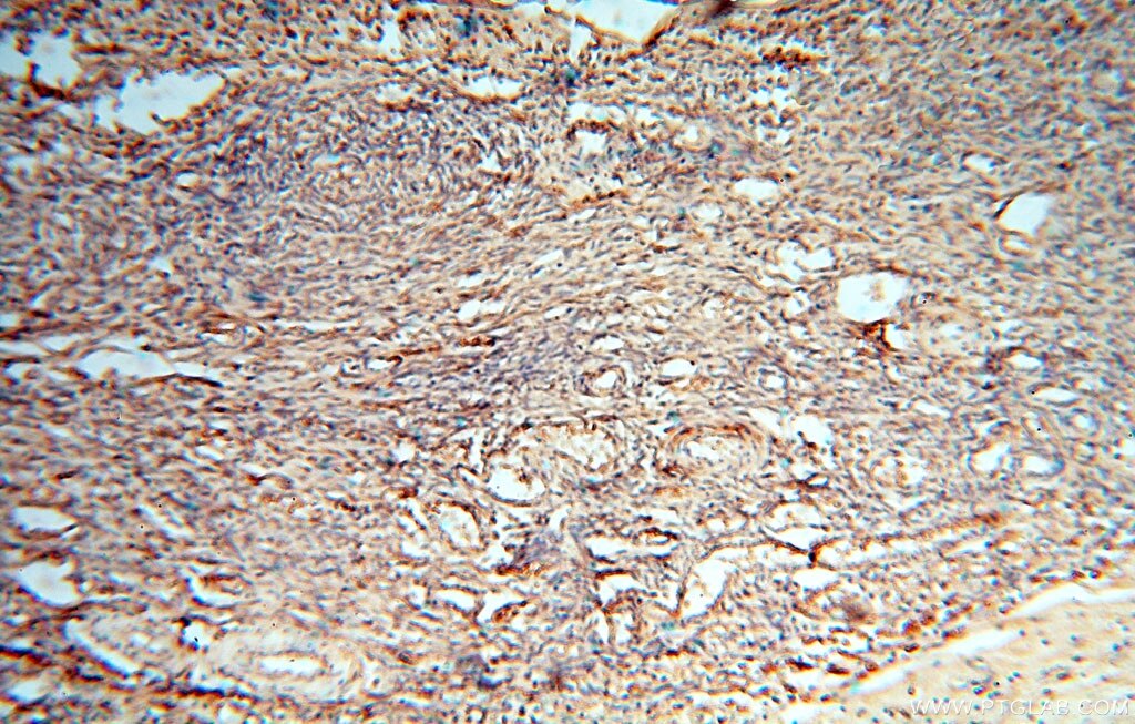 IHC staining of human ovary using 16357-1-AP