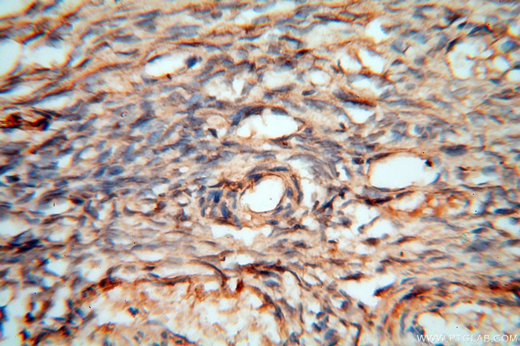 Immunohistochemistry (IHC) staining of human ovary tissue using cyclin I Polyclonal antibody (16357-1-AP)