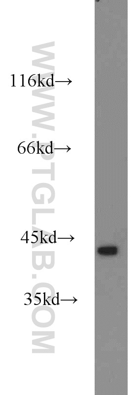 Western Blot (WB) analysis of human brain tissue using cyclin I Polyclonal antibody (16357-1-AP)