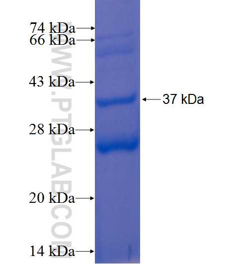 CCNI fusion protein Ag0300 SDS-PAGE