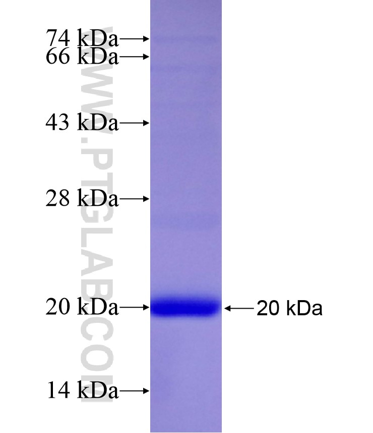 CCNI fusion protein Ag8020 SDS-PAGE