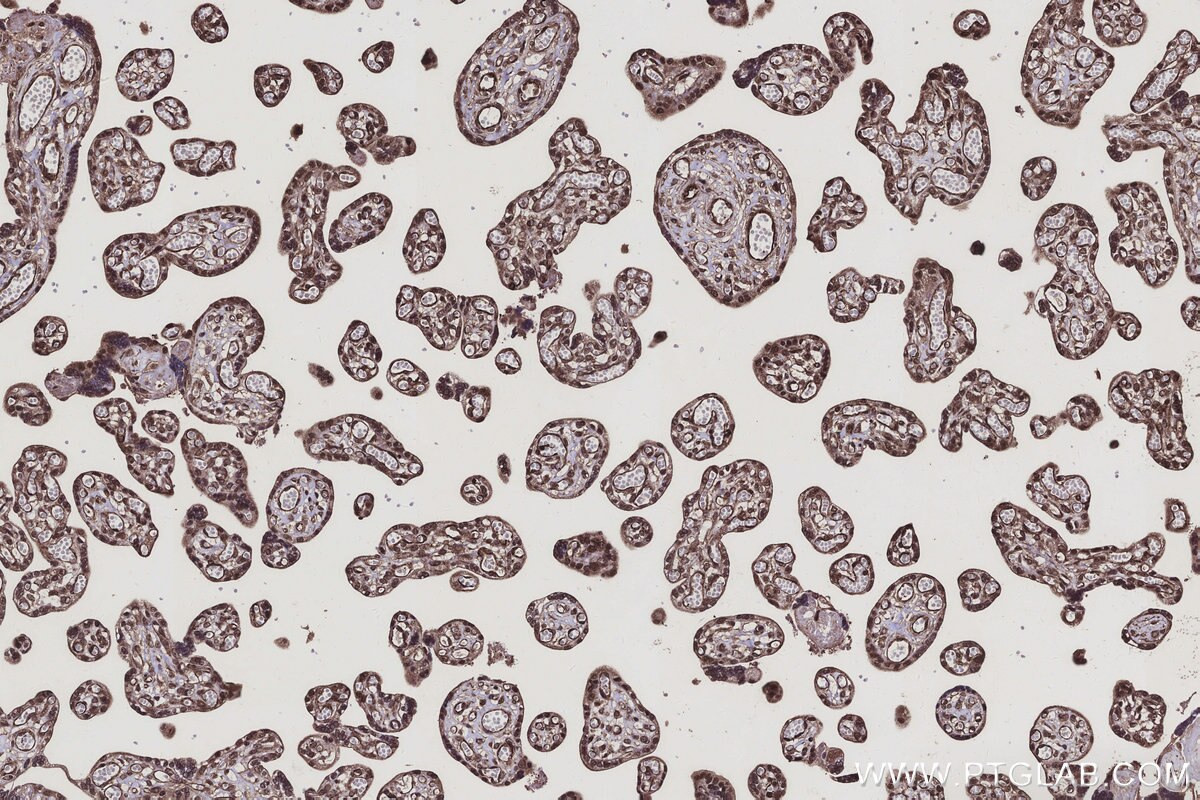 Immunohistochemistry (IHC) staining of human placenta tissue using CCNI2 Polyclonal antibody (18822-1-AP)