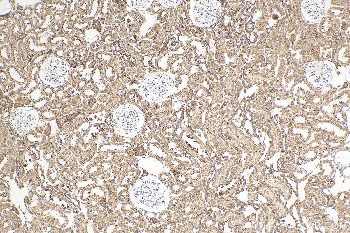 Immunohistochemistry (IHC) staining of rat kidney tissue using CCNJ Polyclonal antibody (15694-1-AP)