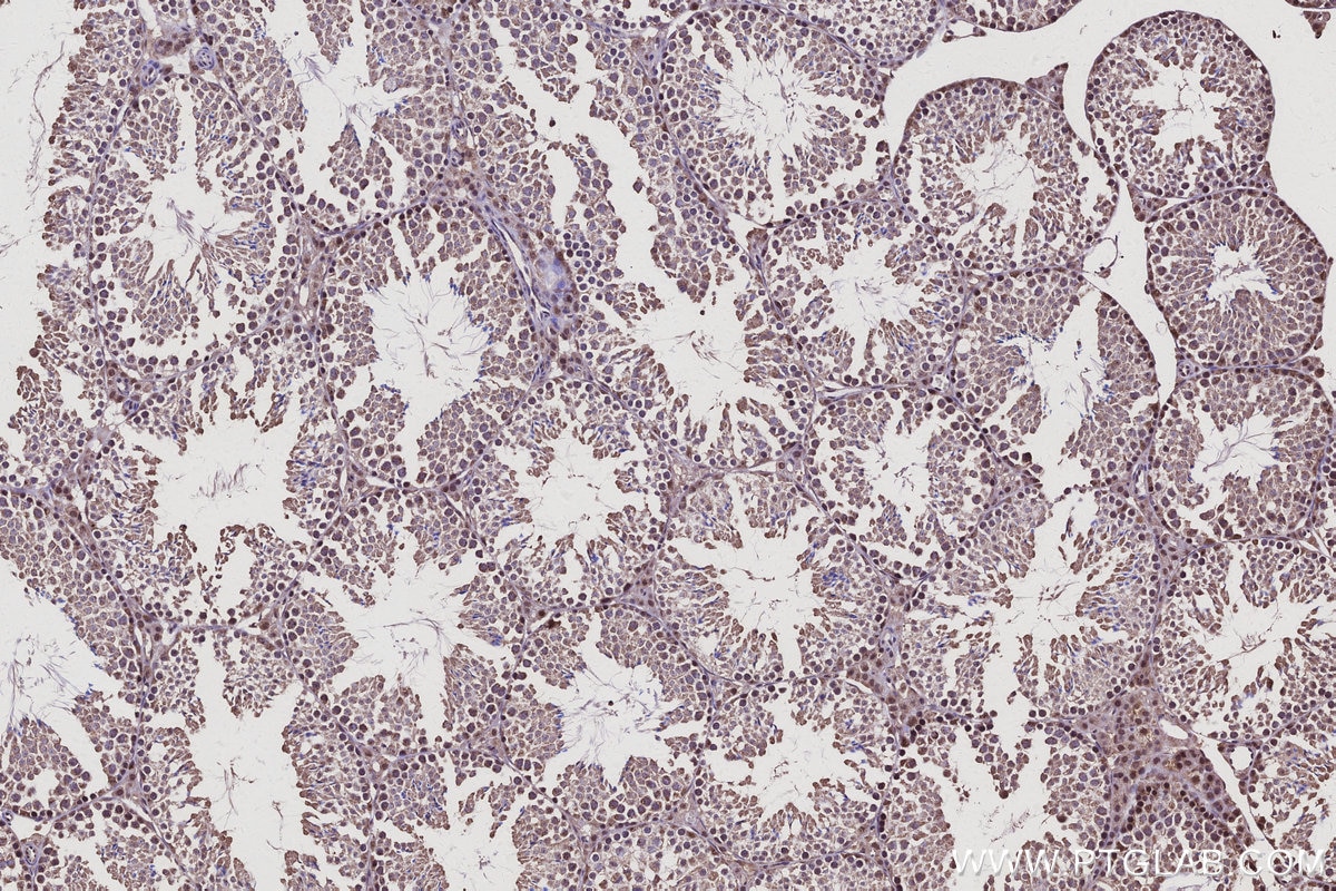 IHC staining of mouse testis using 15694-1-AP Immunohistochemistry (IHC) staining of mouse testis tissue using CCNJ Polyclonal antibody (15694-1-AP)