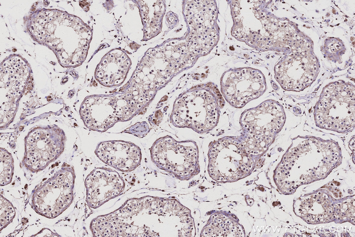 IHC staining of human testis using 15694-1-AP Immunohistochemistry (IHC) staining of human testis tissue using CCNJ Polyclonal antibody (15694-1-AP)