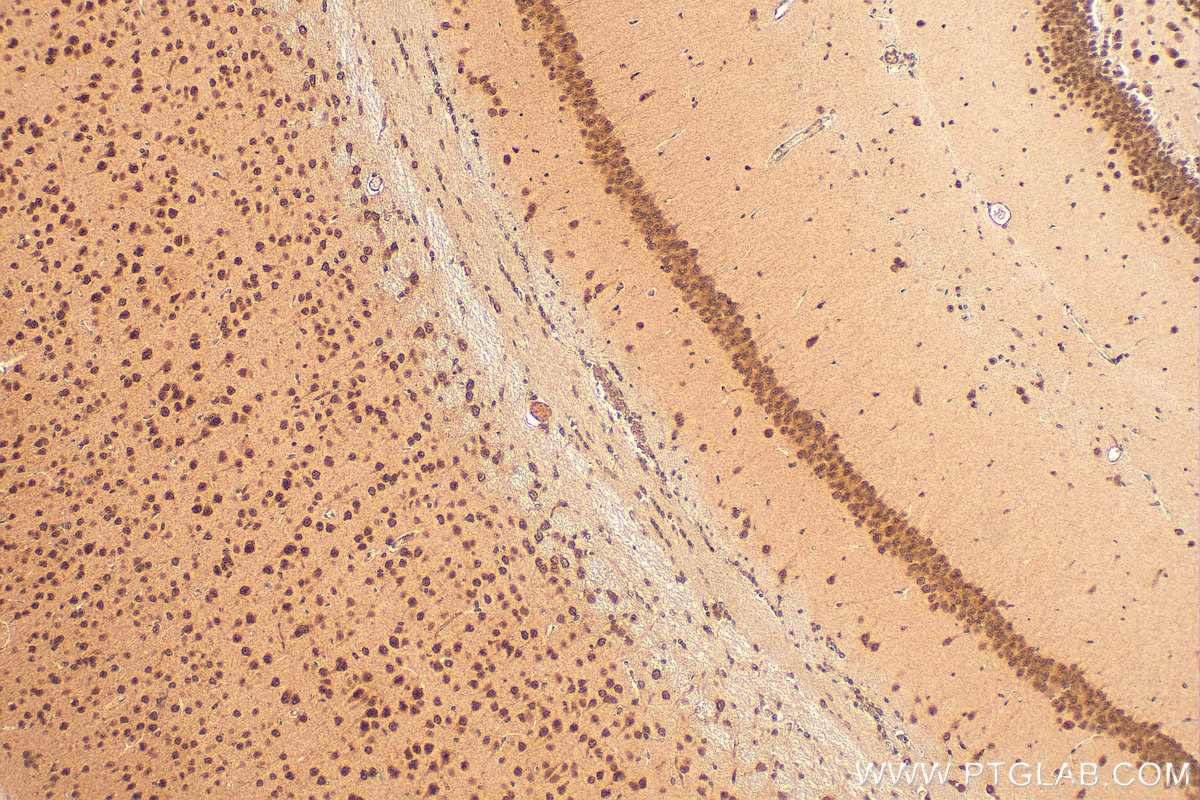 Immunohistochemistry (IHC) staining of mouse brain tissue using CCNK Polyclonal antibody (26933-1-AP)