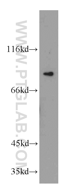 Western Blot (WB) analysis of A431 cells using Cyclin T1 Polyclonal antibody (20992-1-AP)