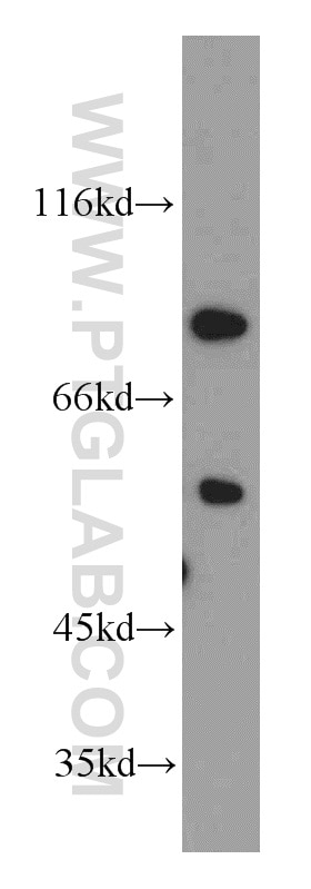 Western Blot (WB) analysis of HeLa cells using Cyclin T1 Polyclonal antibody (20992-1-AP)