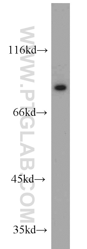 Western Blot (WB) analysis of Jurkat cells using Cyclin T1 Polyclonal antibody (20992-1-AP)