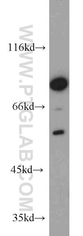 Western Blot (WB) analysis of K-562 cells using Cyclin T1 Polyclonal antibody (20992-1-AP)
