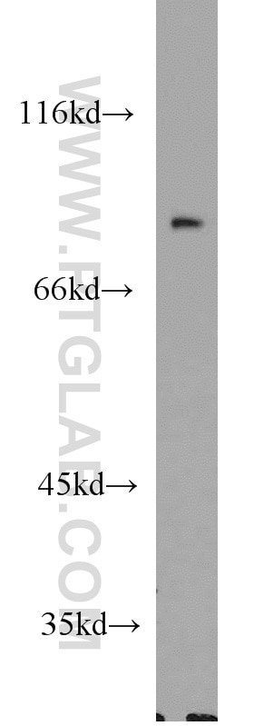 Western Blot (WB) analysis of Y79 cells using Cyclin T1 Polyclonal antibody (20992-1-AP)