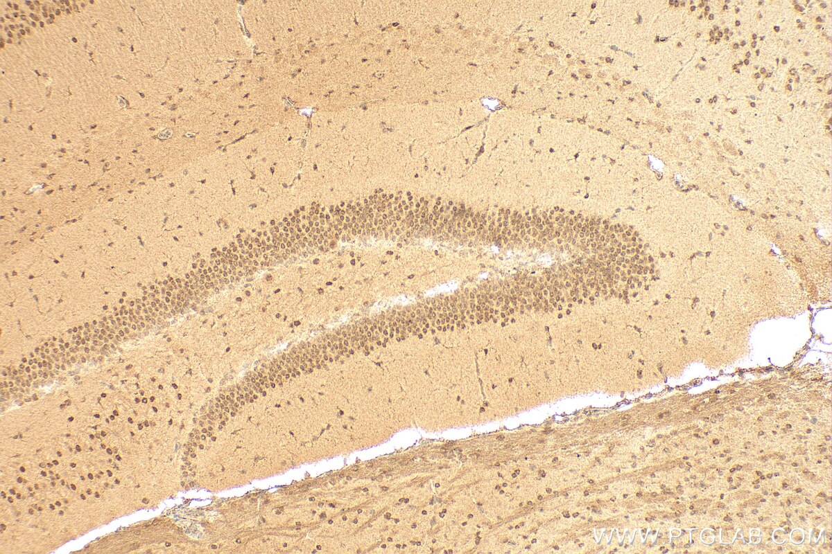 Immunohistochemistry (IHC) staining of mouse brain tissue using cyclin T2 Polyclonal antibody (21860-1-AP)