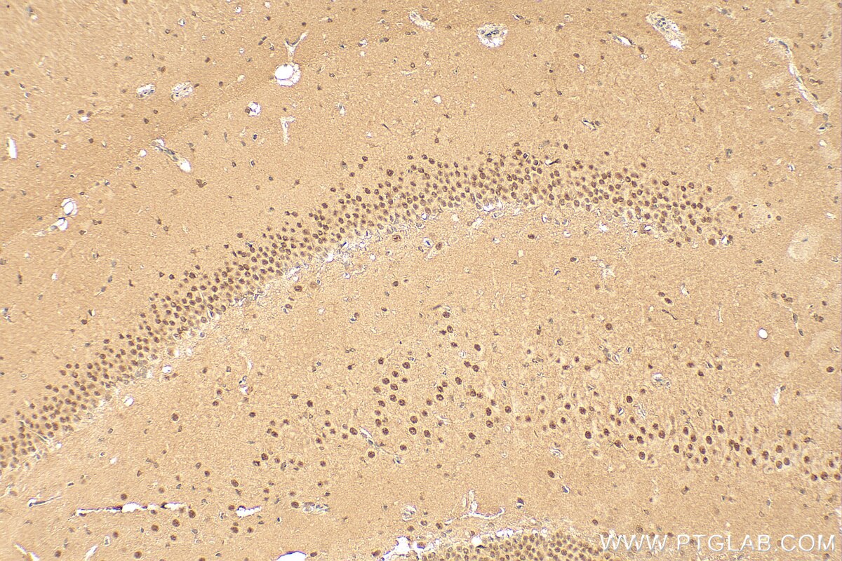 Immunohistochemistry (IHC) staining of rat brain tissue using cyclin T2 Polyclonal antibody (21860-1-AP)