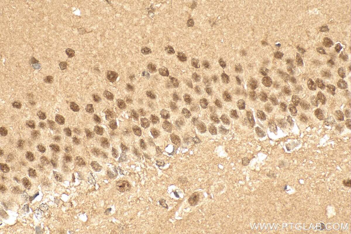 Immunohistochemistry (IHC) staining of rat brain tissue using cyclin T2 Polyclonal antibody (21860-1-AP)
