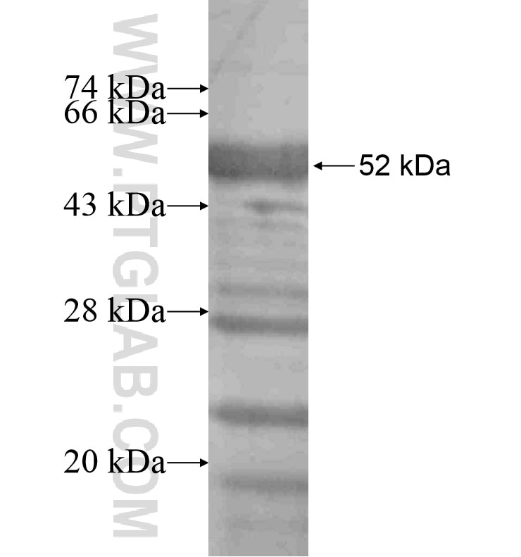 CCNT2 fusion protein Ag16519 SDS-PAGE