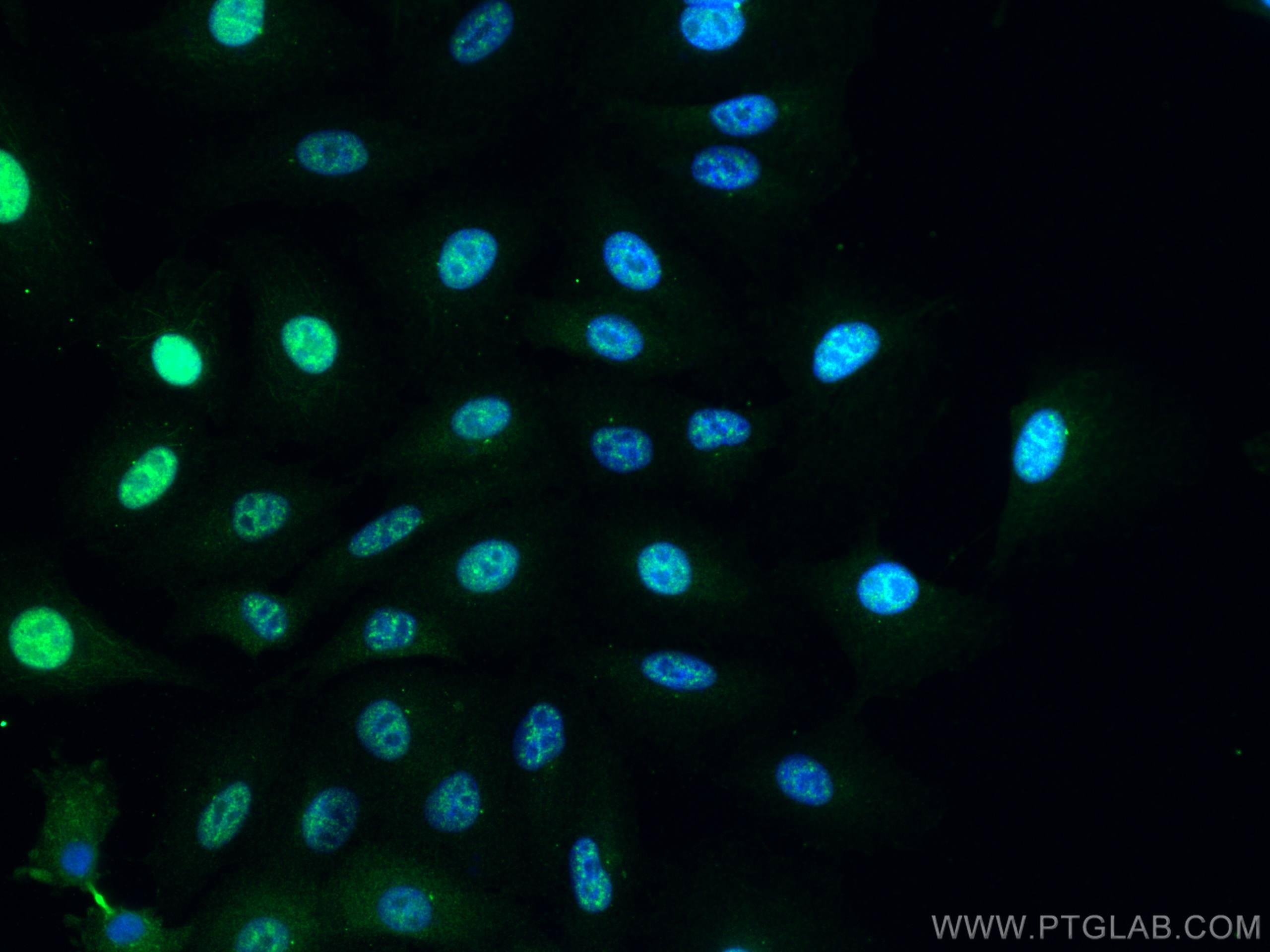 Immunofluorescence (IF) / fluorescent staining of A549 cells using CCNY Polyclonal antibody (18042-1-AP)
