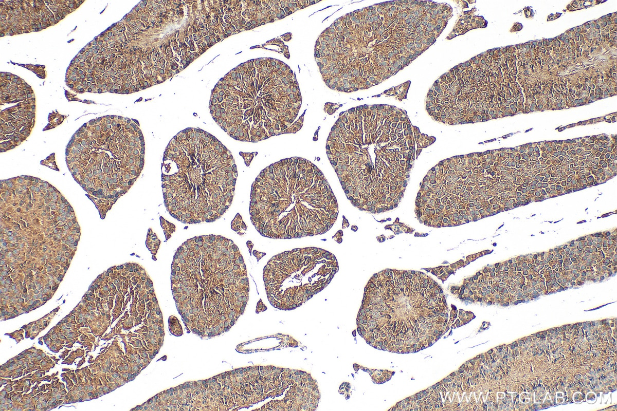 Immunohistochemistry (IHC) staining of mouse testis tissue using CCNY Polyclonal antibody (18042-1-AP)