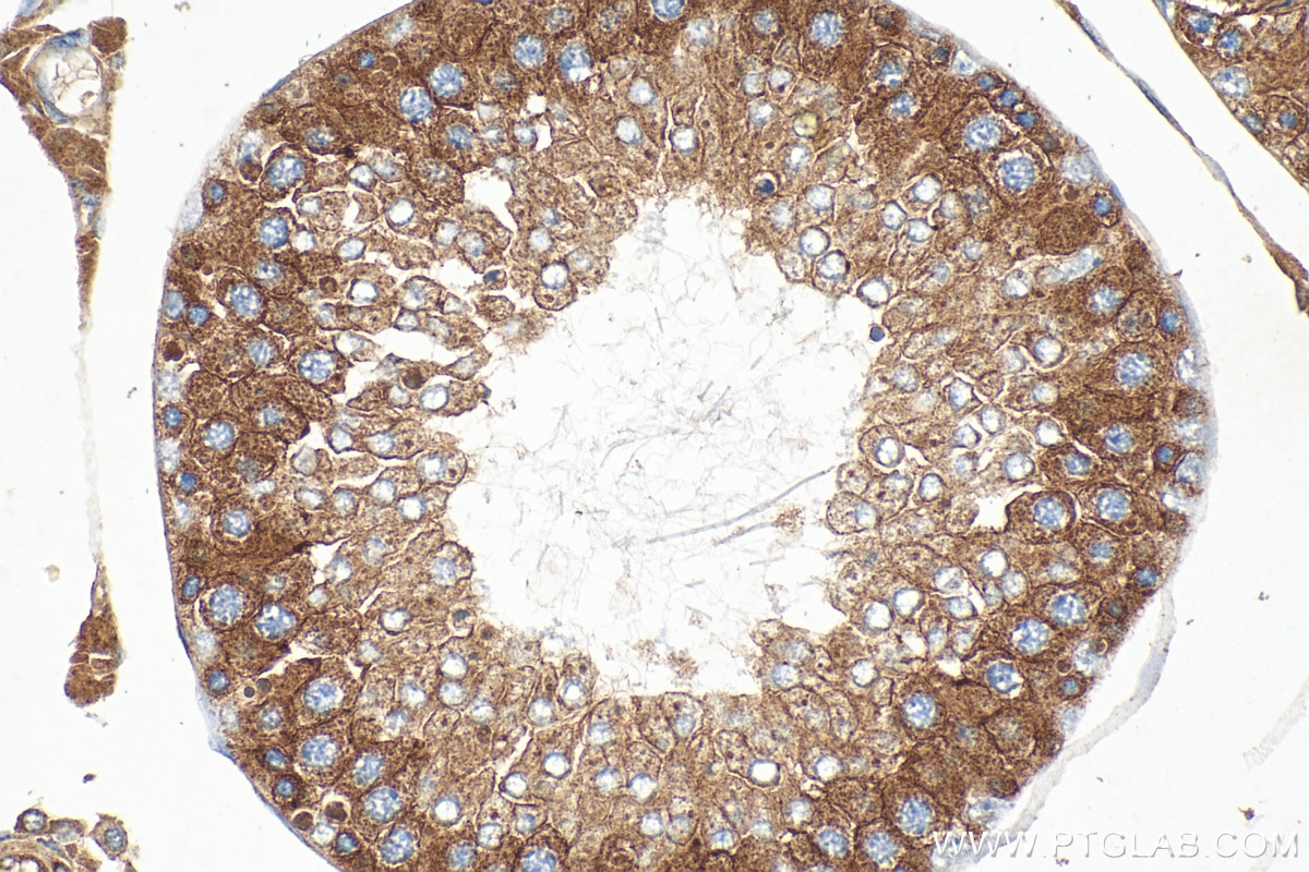 Immunohistochemistry (IHC) staining of rat testis tissue using CCNY Polyclonal antibody (18042-1-AP)