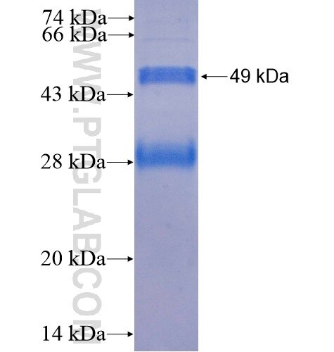CCNY fusion protein Ag12674 SDS-PAGE