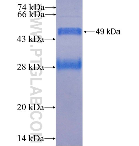 CCNY fusion protein Ag12674 SDS-PAGE