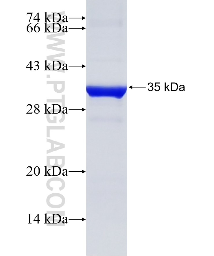 CCNY fusion protein Ag12691 SDS-PAGE