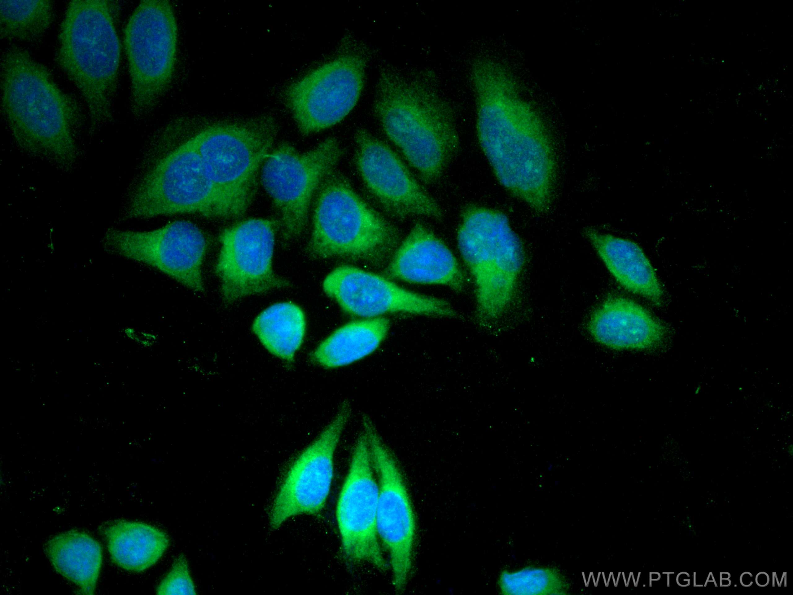 Immunofluorescence (IF) / fluorescent staining of HepG2 cells using CCPG1 Polyclonal antibody (13861-1-AP)