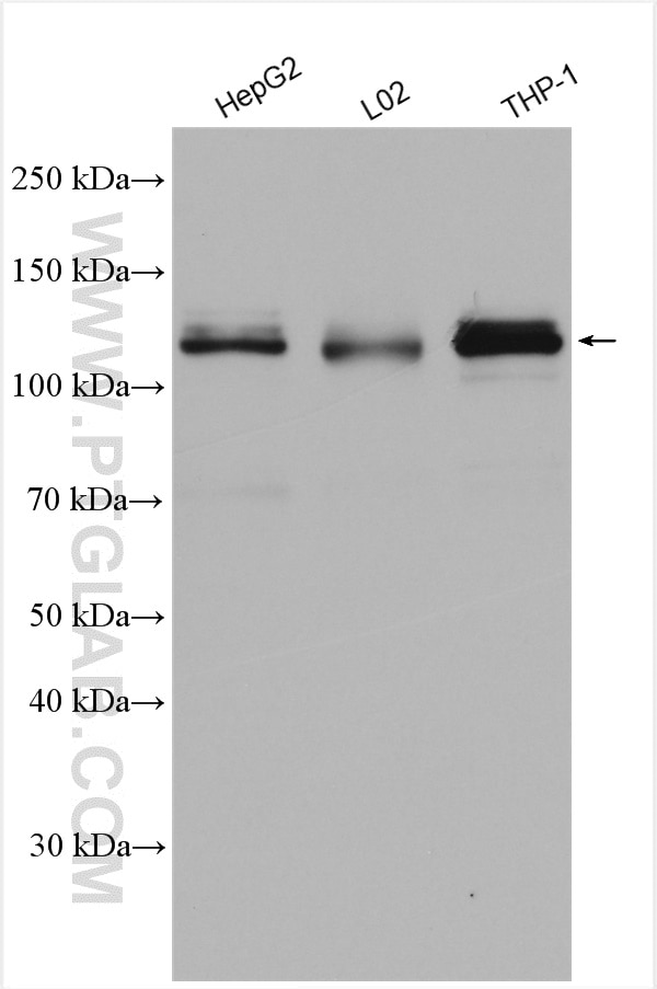 Western Blot (WB) analysis of various lysates using CCPG1 Polyclonal antibody (13861-1-AP)