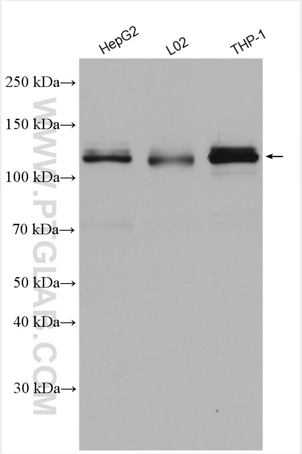 WB analysis using 13861-1-AP