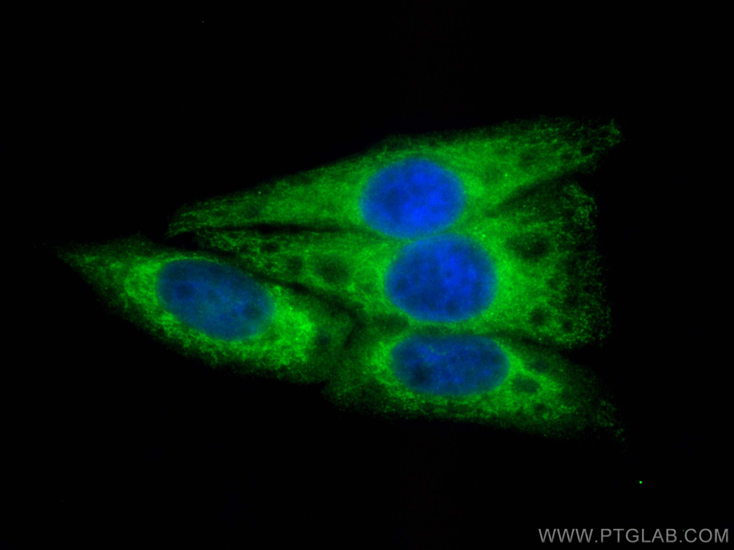 Immunofluorescence (IF) / fluorescent staining of HepG2 cells using CoraLite® Plus 488-conjugated CCPG1 Polyclonal ant (CL488-13861)