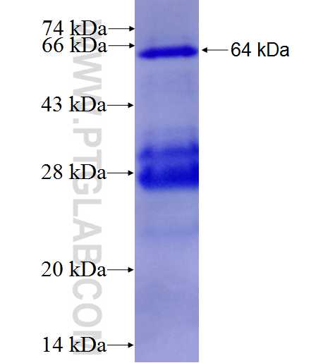CCPG1 fusion protein Ag4841 SDS-PAGE