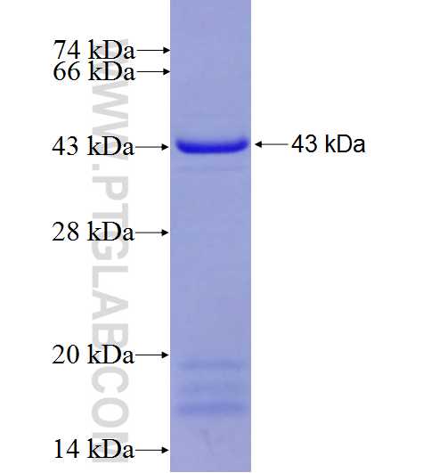 CCPG1 fusion protein Ag5037 SDS-PAGE