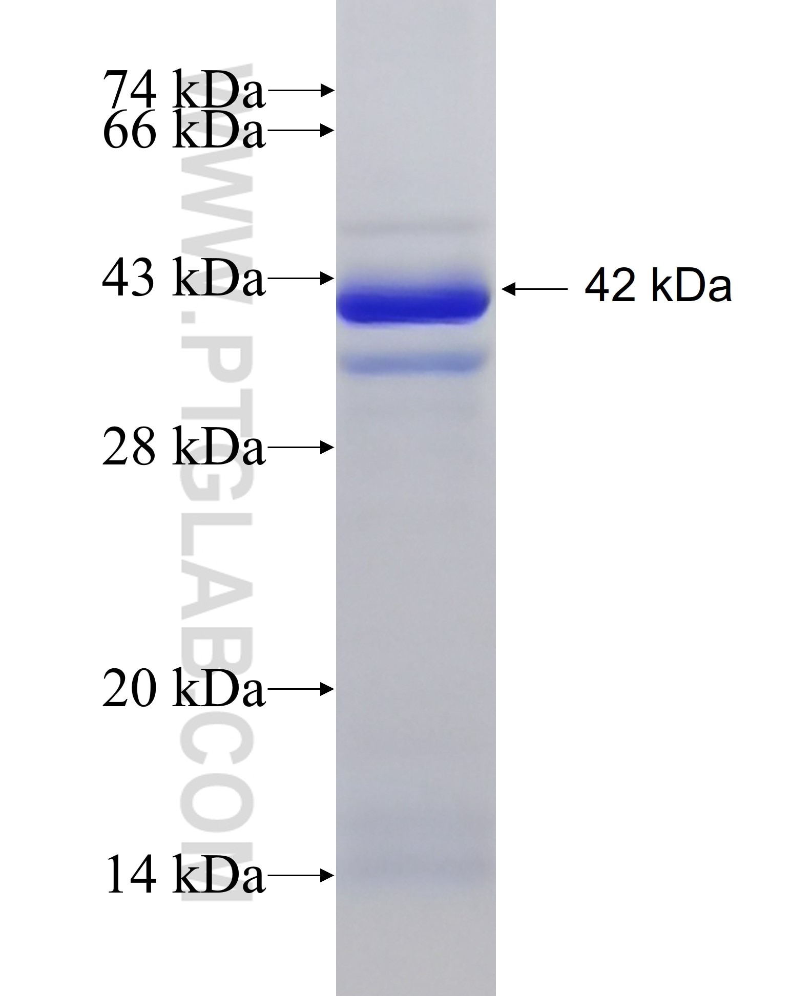 CCPG1 fusion protein Ag5037 SDS-PAGE