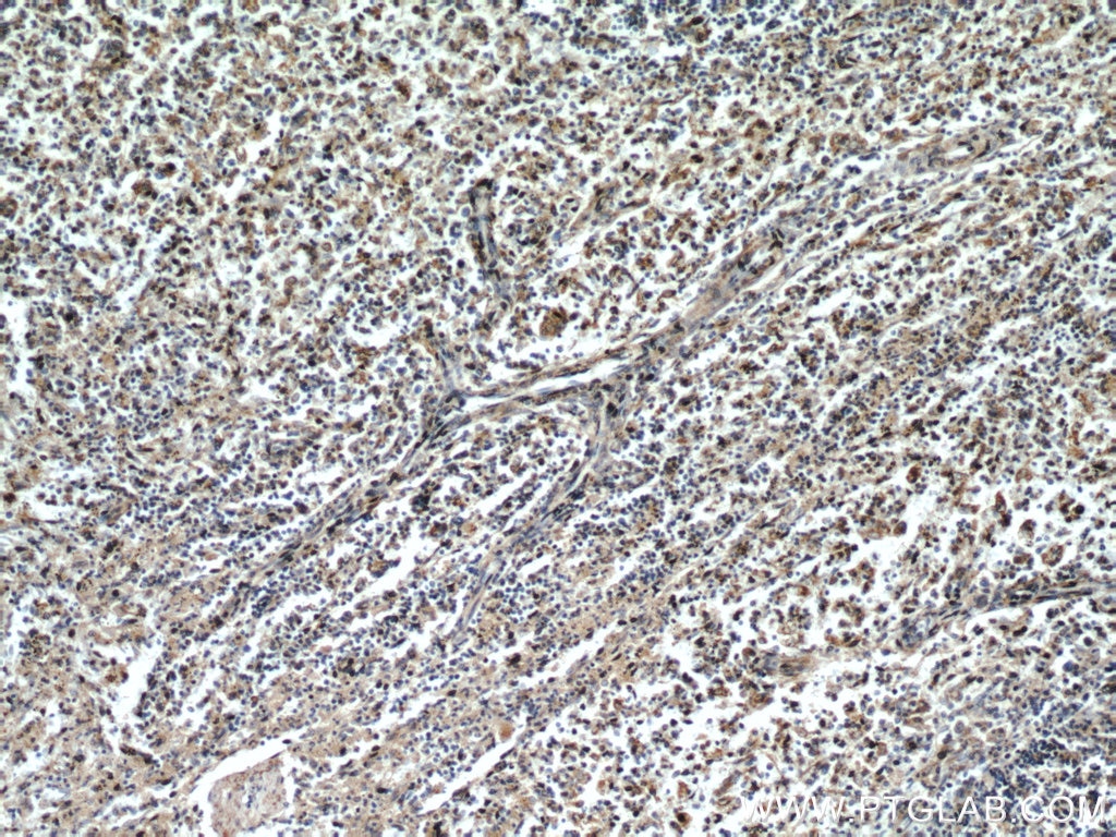 Immunohistochemistry (IHC) staining of human spleen tissue using CCR10 Polyclonal antibody (22071-1-AP)