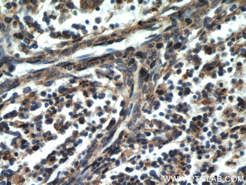 Immunohistochemistry (IHC) staining of human spleen tissue using CCR10 Polyclonal antibody (22071-1-AP)