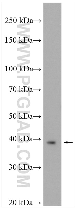 Western Blot (WB) analysis of rat brain tissue using CCR10 Polyclonal antibody (22071-1-AP)