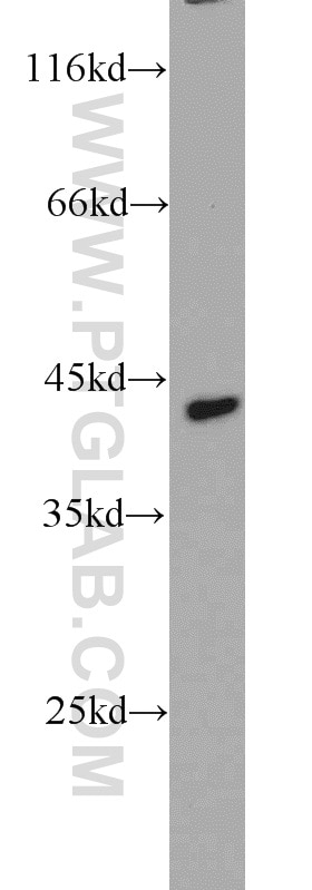 Western Blot (WB) analysis of mouse brain tissue using CCR10 Polyclonal antibody (22071-1-AP)