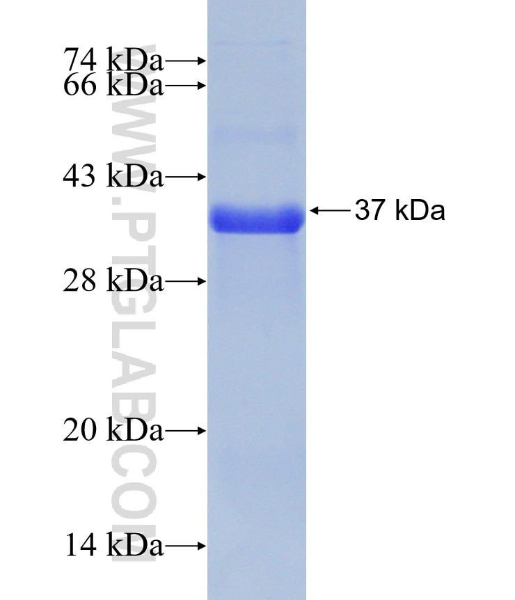 CCR10 fusion protein Ag16401 SDS-PAGE