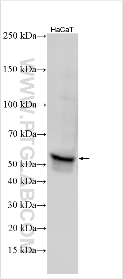 WB analysis using 30420-1-AP Western Blot (WB) analysis of various lysates using CCR2 Polyclonal antibody (30420-1-AP)