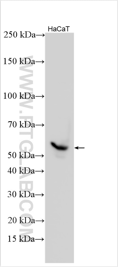 Western Blot (WB) analysis of various lysates using CCR2 Polyclonal antibody (30420-1-AP)