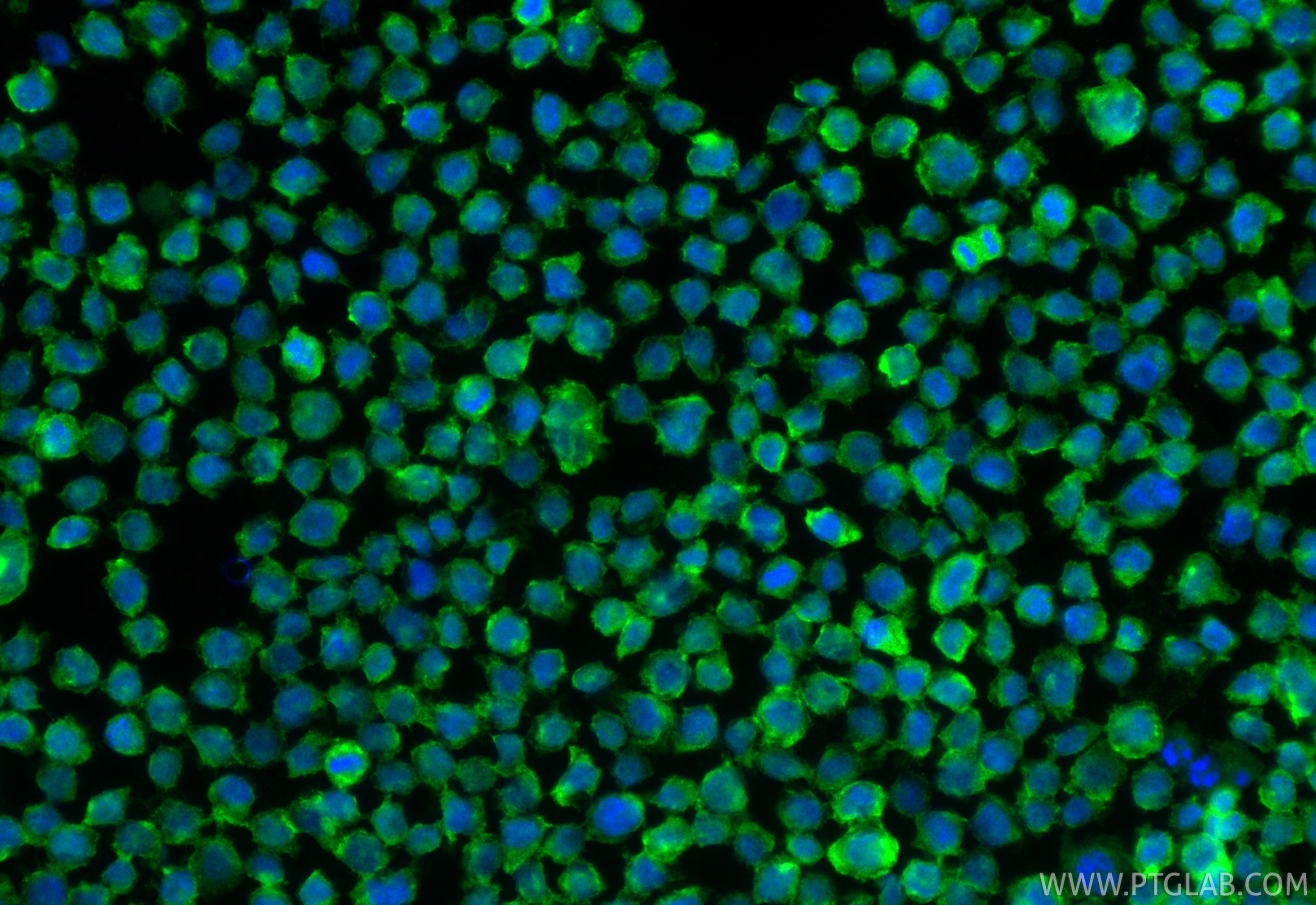 IF Staining of THP-1 using 16153-1-AP Immunofluorescence (IF) / fluorescent staining of THP-1 cells using CCR2a-specific Polyclonal antibody (16153-1-AP)
