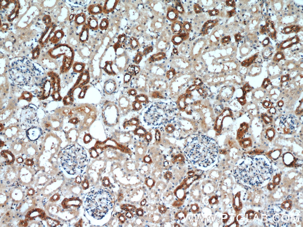 Immunohistochemistry (IHC) staining of human kidney tissue using CCR2a-specific Polyclonal antibody (16153-1-AP)