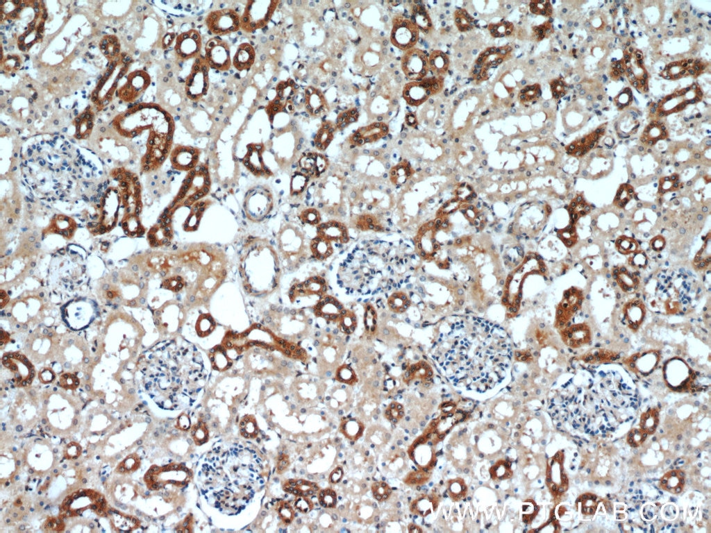 IHC staining of human kidney using 16153-1-AP