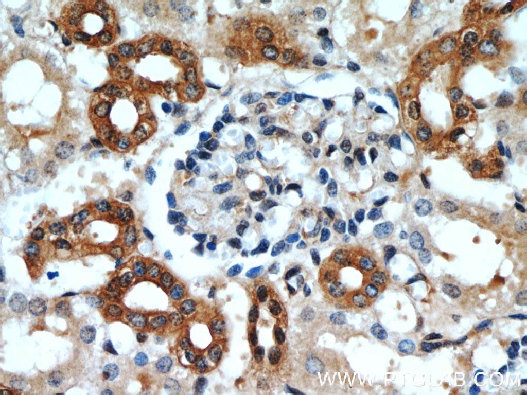 Immunohistochemistry (IHC) staining of human kidney tissue using CCR2a-specific Polyclonal antibody (16153-1-AP)