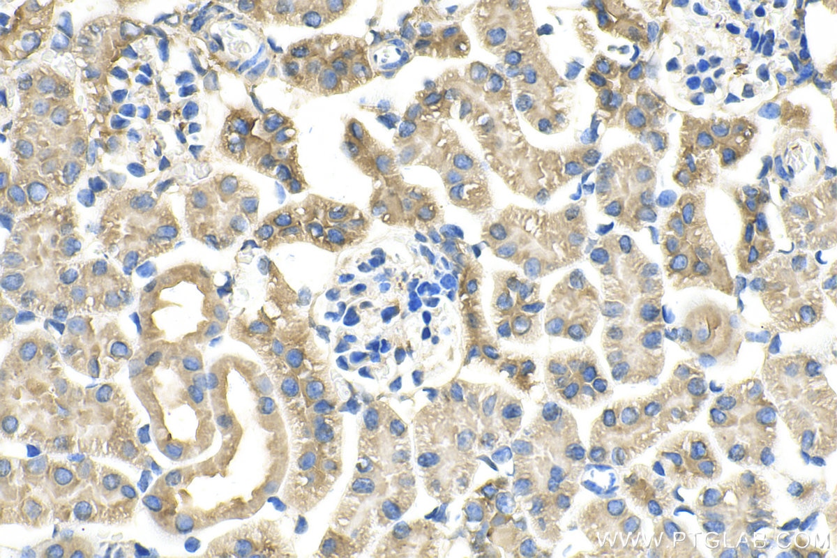 Immunohistochemistry (IHC) staining of mouse kidney tissue using CCR2a-specific Polyclonal antibody (16153-1-AP)