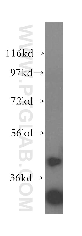 Western Blot (WB) analysis of A431 cells using CCR2a-specific Polyclonal antibody (16153-1-AP)