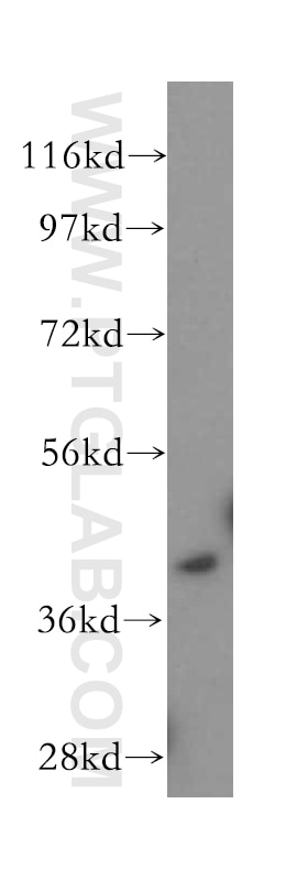 Western Blot (WB) analysis of Jurkat cells using CCR2a-specific Polyclonal antibody (16153-1-AP)